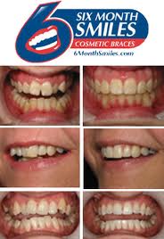 6-month-smile-imagesimages