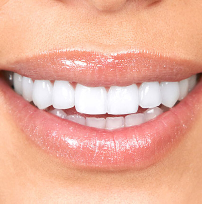 blog - Cheadle Hulme Dental