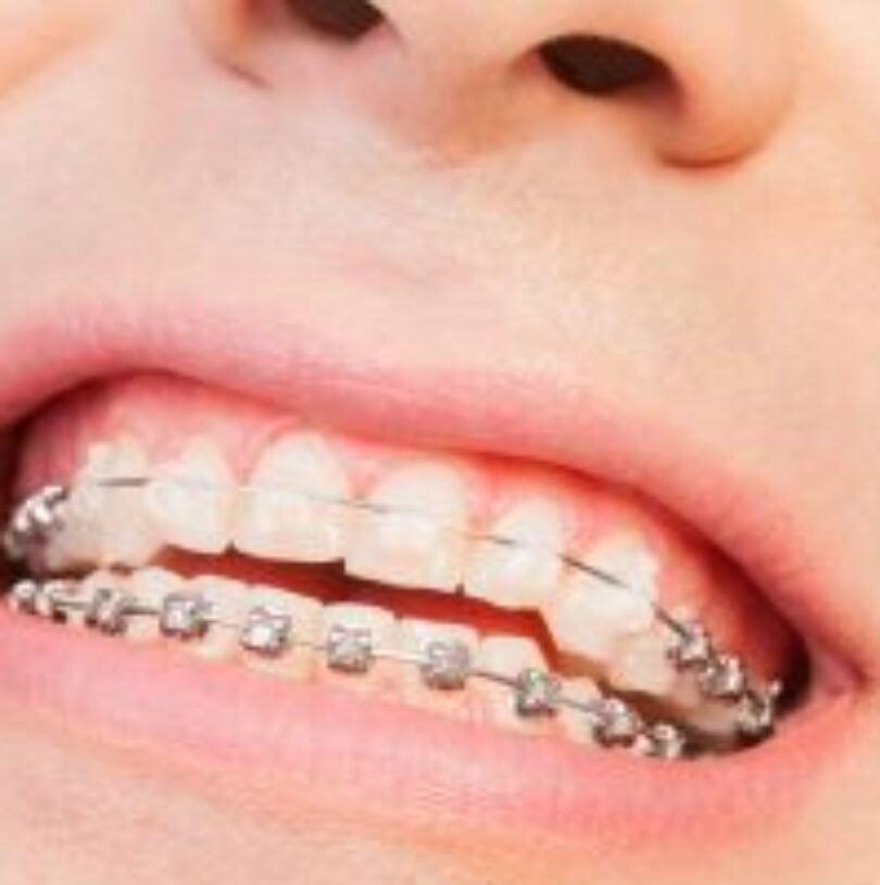 blog - Cheadle Hulme Dental
