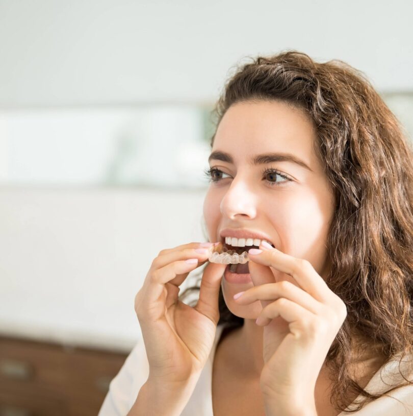 blog - Cheadle Hulme Dental