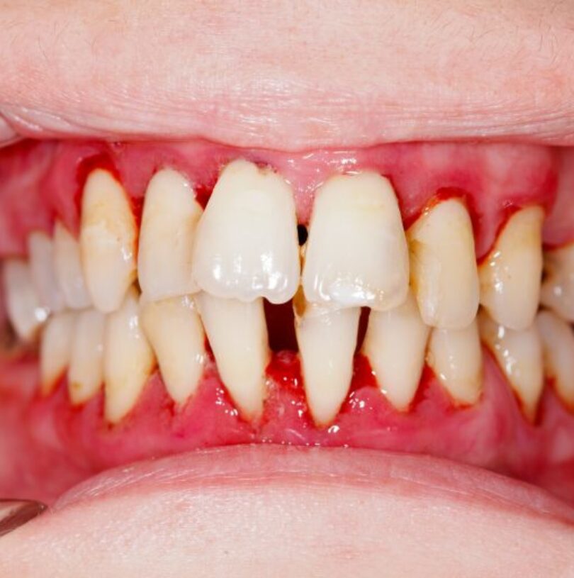blog - Cheadle Hulme Dental