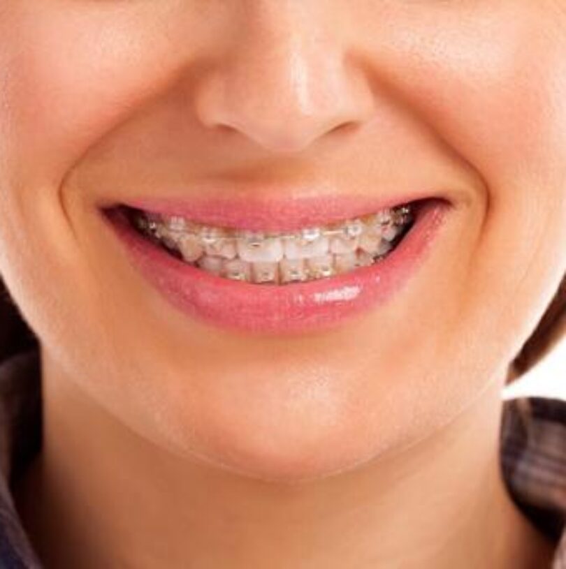 blog - Cheadle Hulme Dental