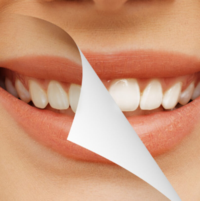 blog - Cheadle Hulme Dental