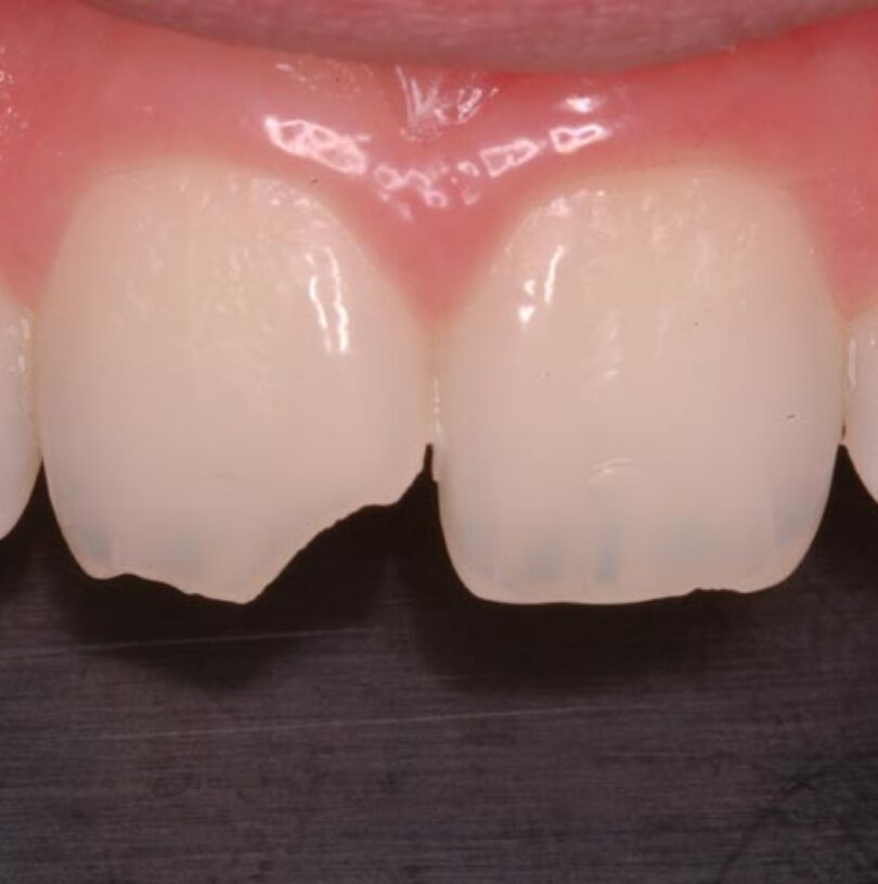 blog - Cheadle Hulme Dental