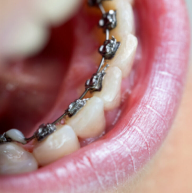 blog - Cheadle Hulme Dental
