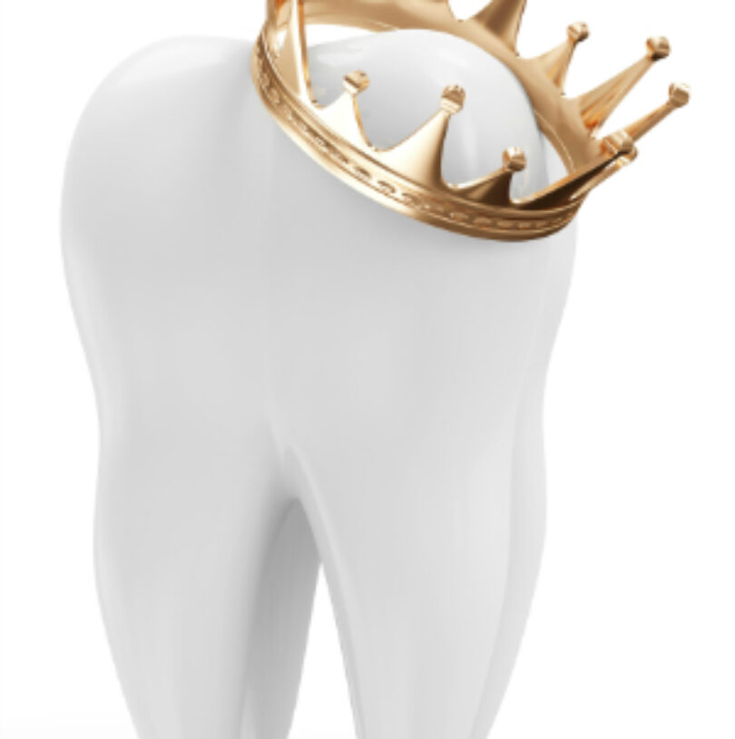 blog - Cheadle Hulme Dental