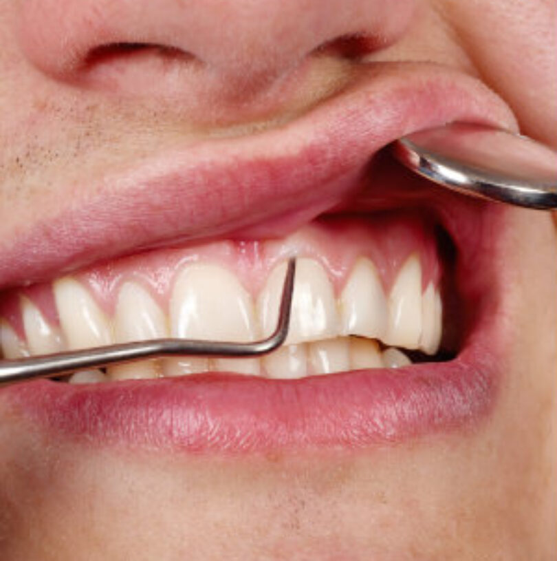 blog - Cheadle Hulme Dental