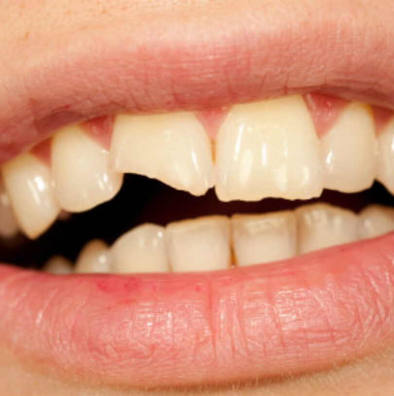 blog - Cheadle Hulme Dental