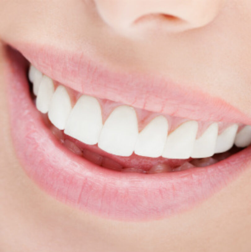 blog - Cheadle Hulme Dental