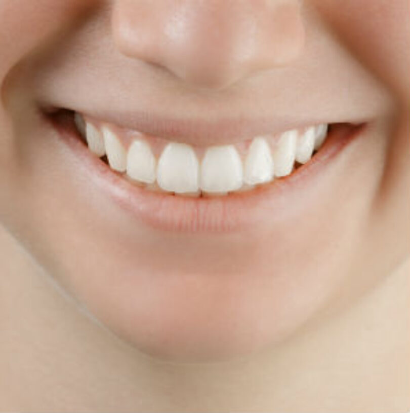 blog - Cheadle Hulme Dental
