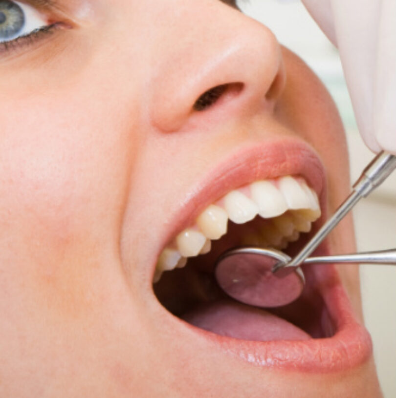 blog - Cheadle Hulme Dental