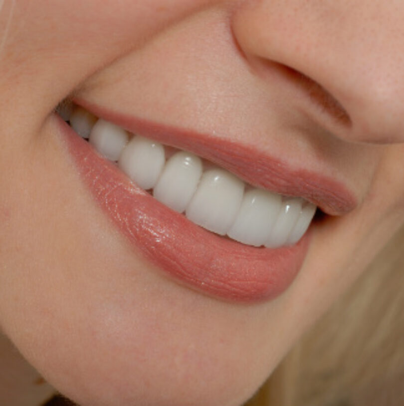 blog - Cheadle Hulme Dental