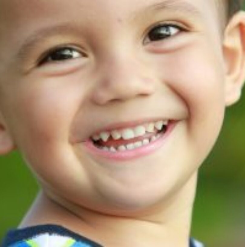 blog - Cheadle Hulme Dental