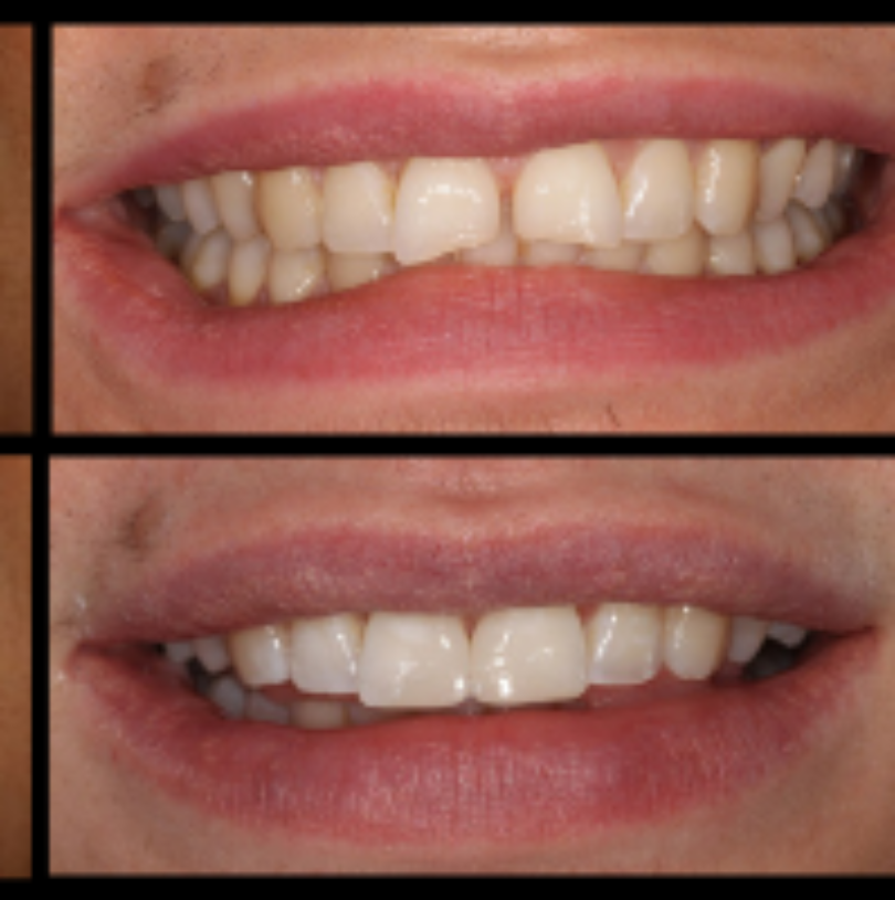 blog - Cheadle Hulme Dental