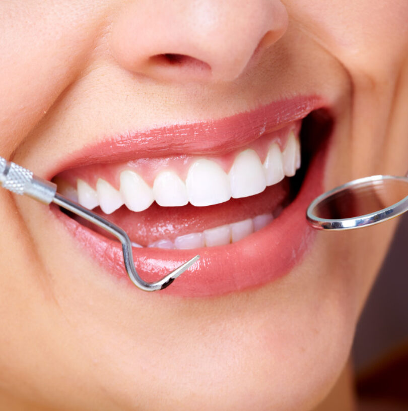 blog - Cheadle Hulme Dental