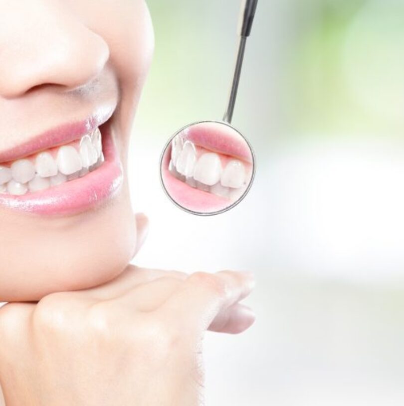 blog - Cheadle Hulme Dental