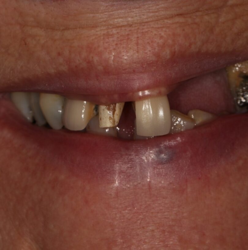 blog - Cheadle Hulme Dental