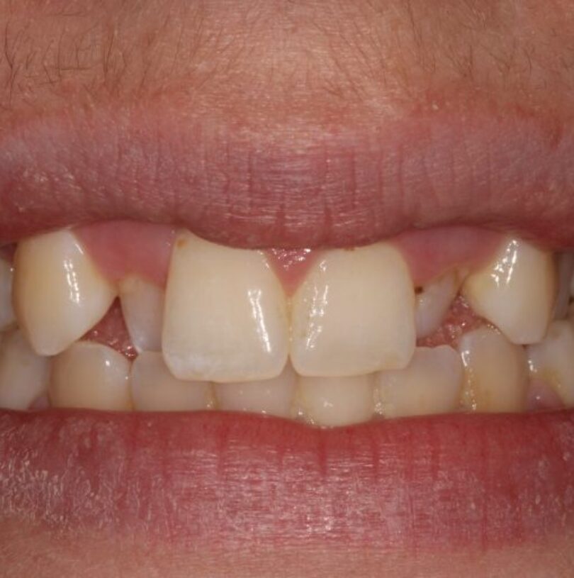 blog - Cheadle Hulme Dental