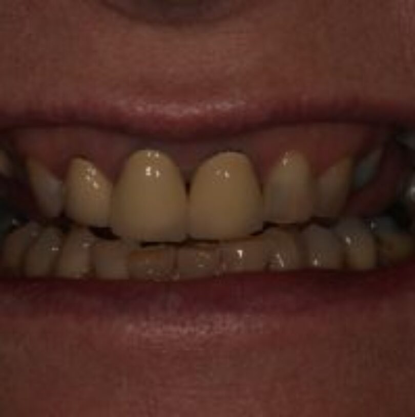 blog - Cheadle Hulme Dental
