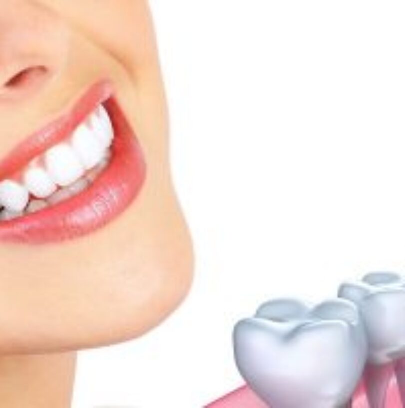 blog - Cheadle Hulme Dental