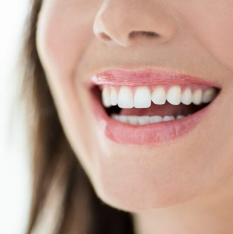 blog - Cheadle Hulme Dental