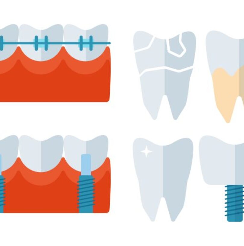 blog - Cheadle Hulme Dental