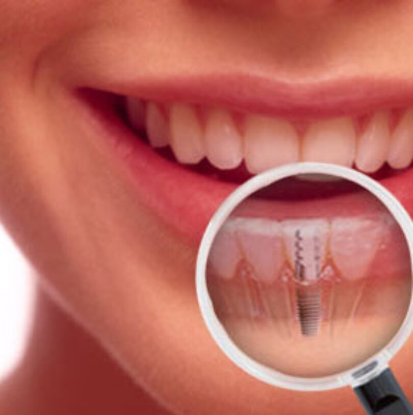 blog - Cheadle Hulme Dental