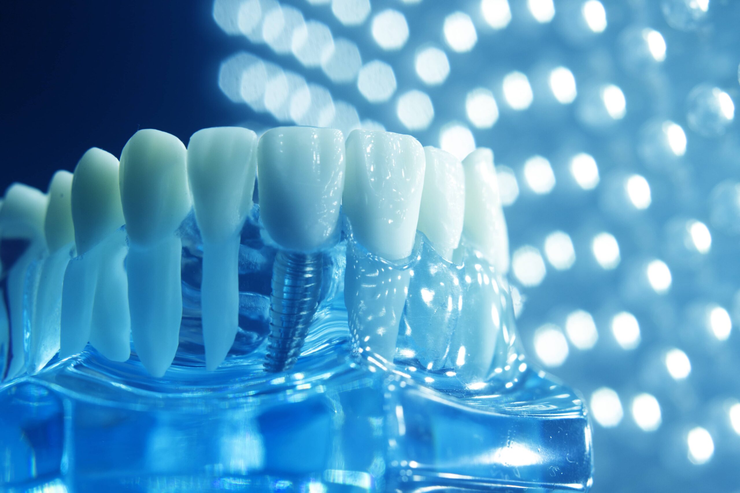 Why Are a Growing Number of People Choosing Invisalign? Cheadle Hulme Dental & Cosmetics Why Are a Growing Number of People Choosing Invisalign? Cheadle Hulme Dental & Cosmetics