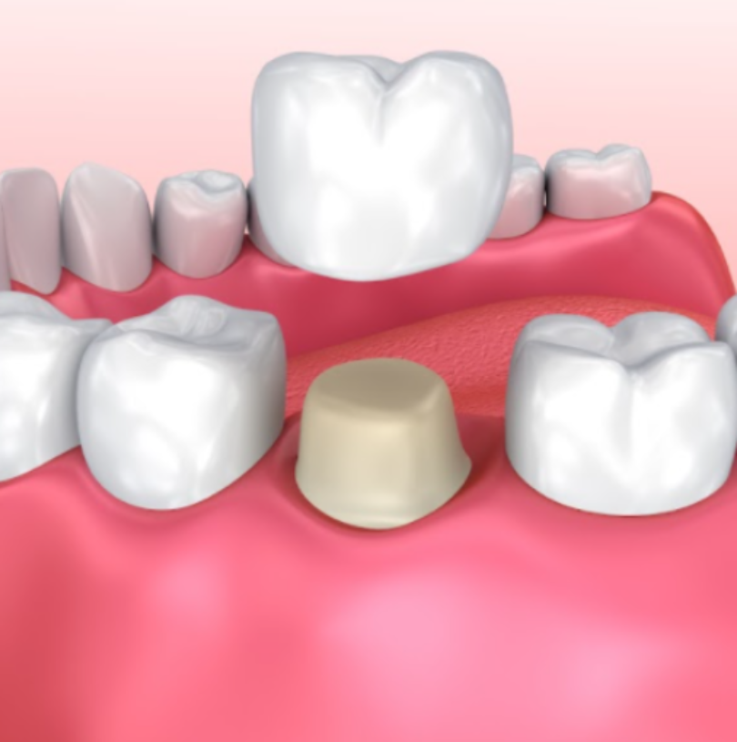 blog - Cheadle Hulme Dental