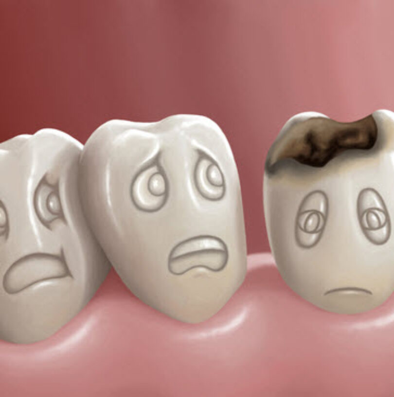 curodont treatment in manchester-prevent fillings in the teeth