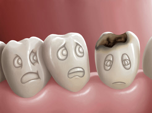 curodont treatment in manchester-prevent fillings in the teeth