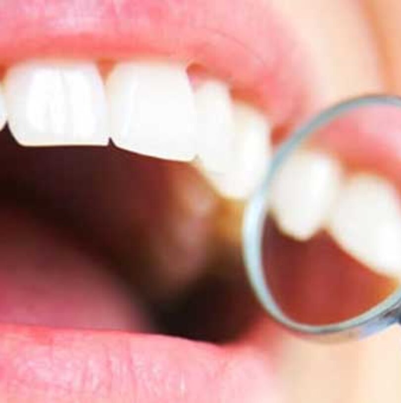 blog - Cheadle Hulme Dental