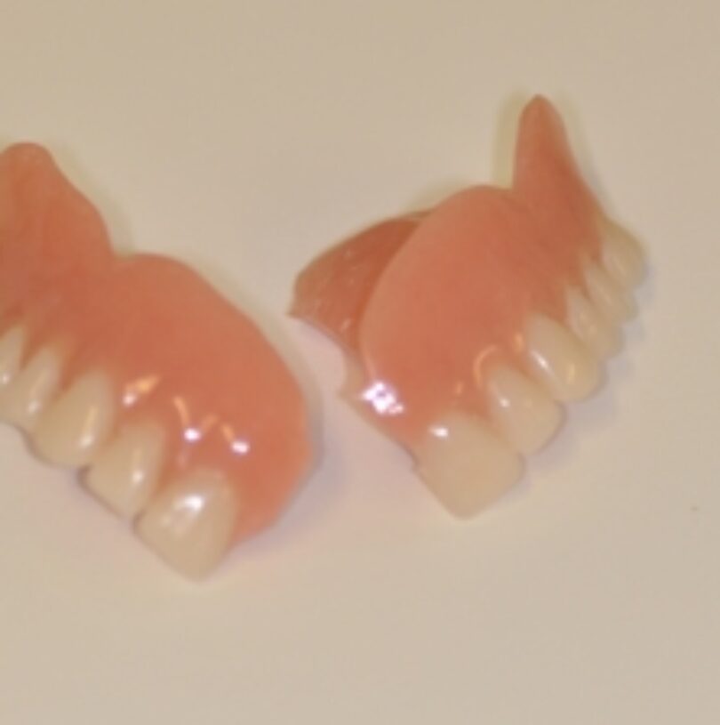 blog - Cheadle Hulme Dental