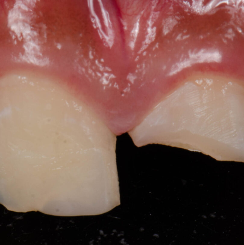 blog - Cheadle Hulme Dental