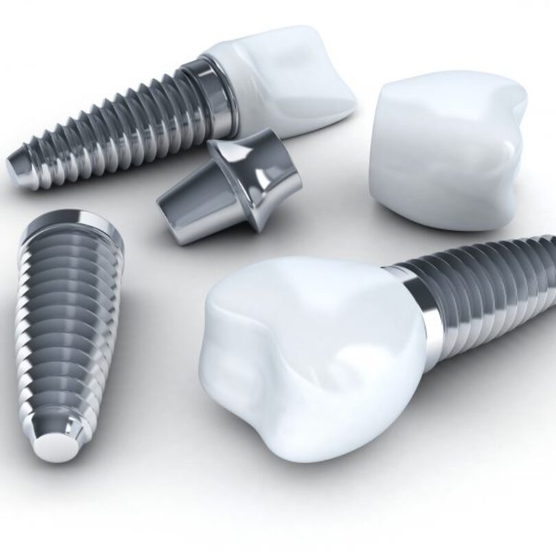 blog - Cheadle Hulme Dental