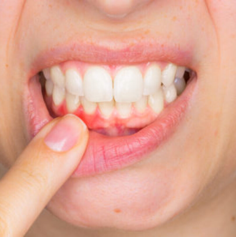 blog - Cheadle Hulme Dental