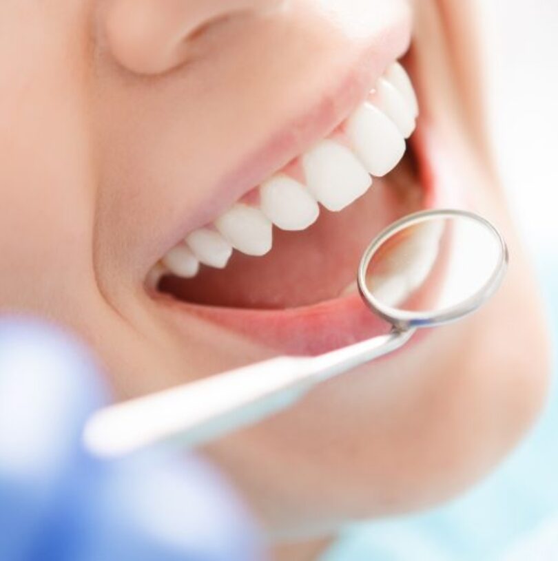 blog - Cheadle Hulme Dental