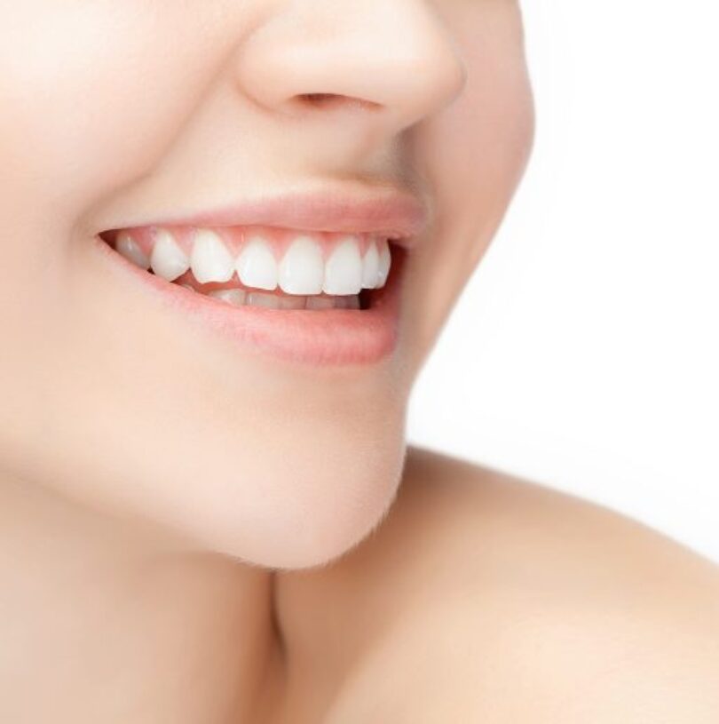 natural smile makeover in manchester