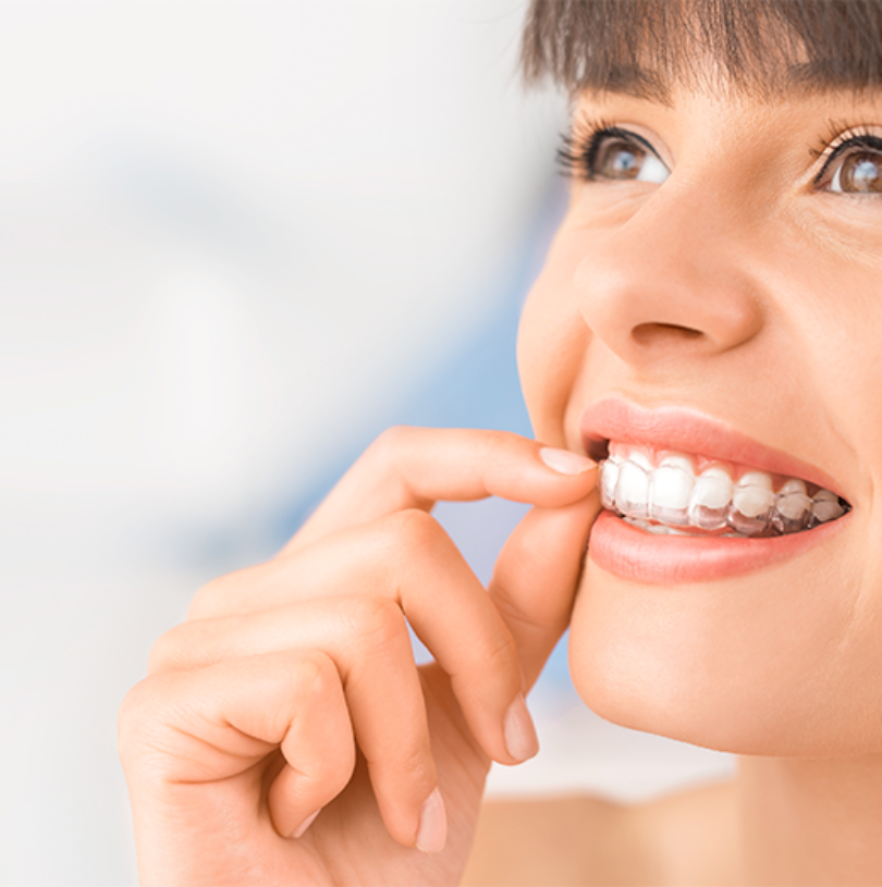 blog - Cheadle Hulme Dental