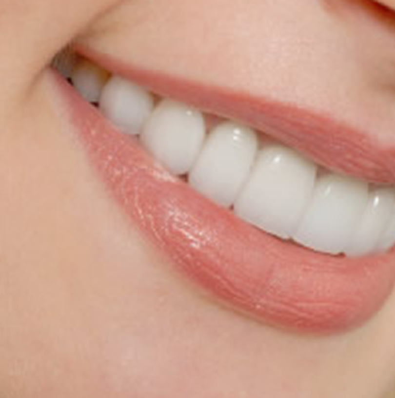 blog - Cheadle Hulme Dental