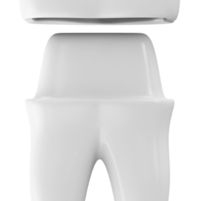 blog - Cheadle Hulme Dental