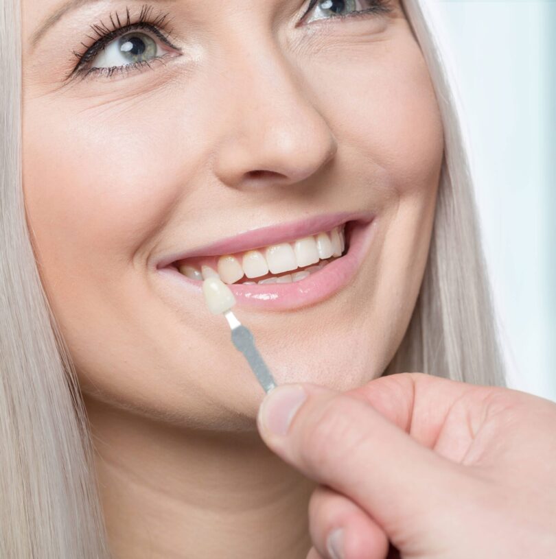 blog - Cheadle Hulme Dental