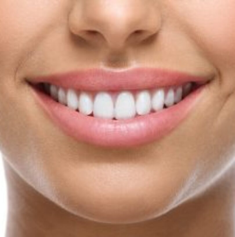 blog - Cheadle Hulme Dental