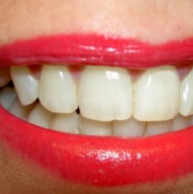 blog - Cheadle Hulme Dental