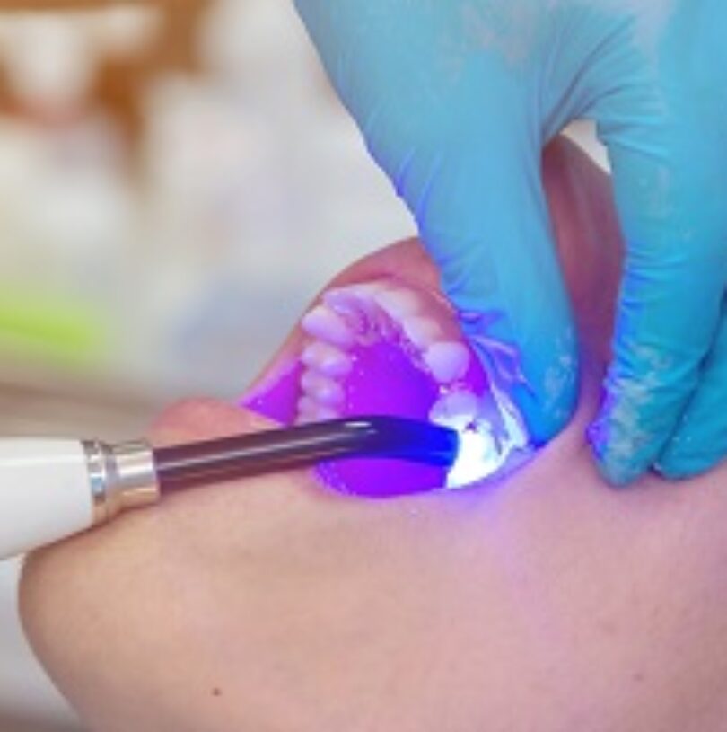 blog - Cheadle Hulme Dental