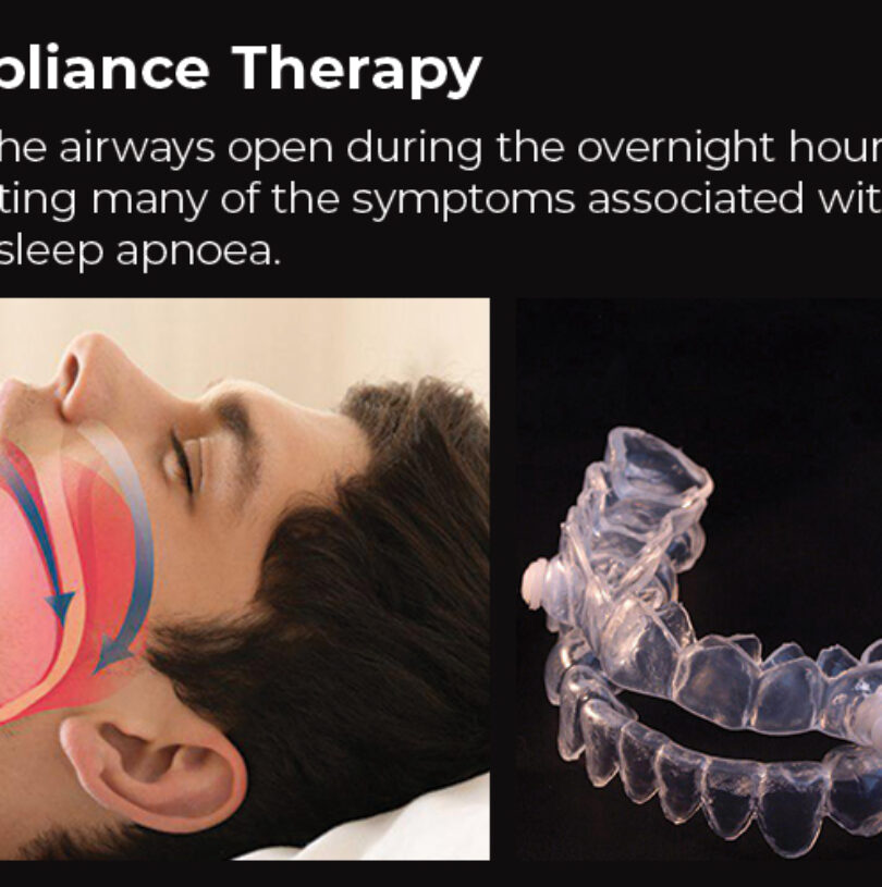 blog - Cheadle Hulme Dental