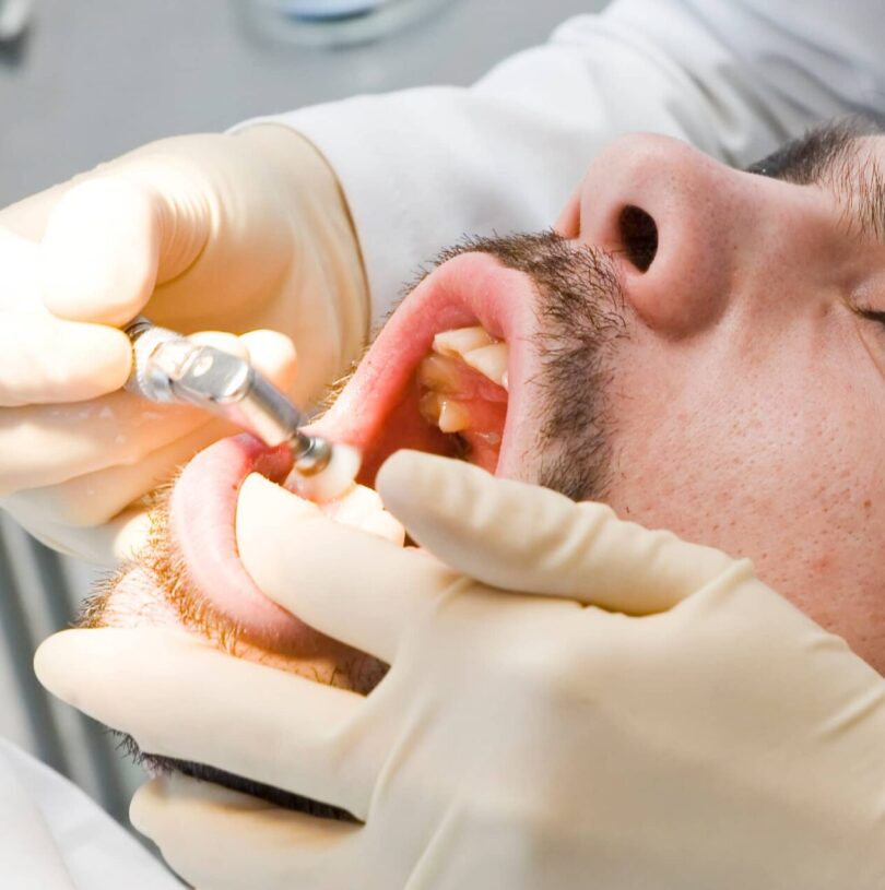 Pain-Free Dental Solutions With Dental Sedation Manchester