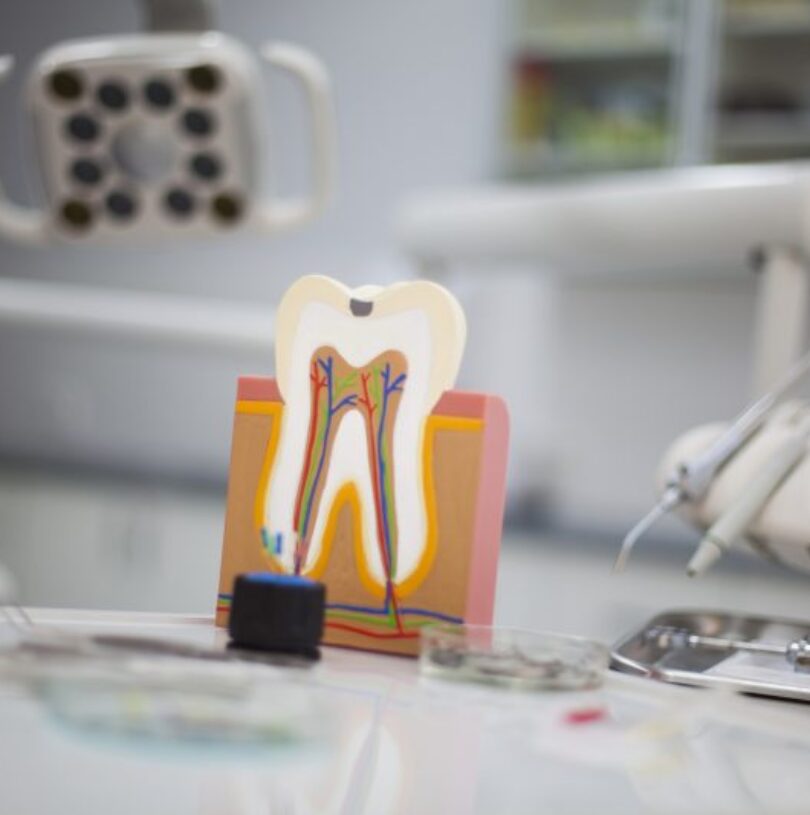 blog - Cheadle Hulme Dental