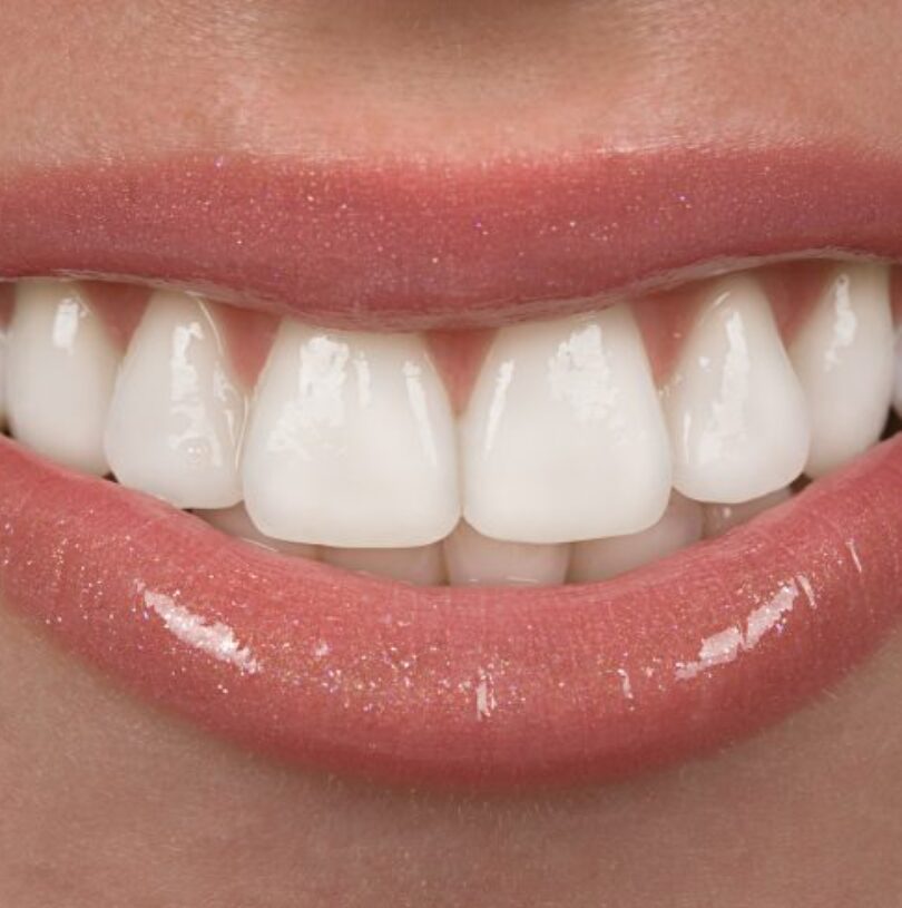 blog - Cheadle Hulme Dental