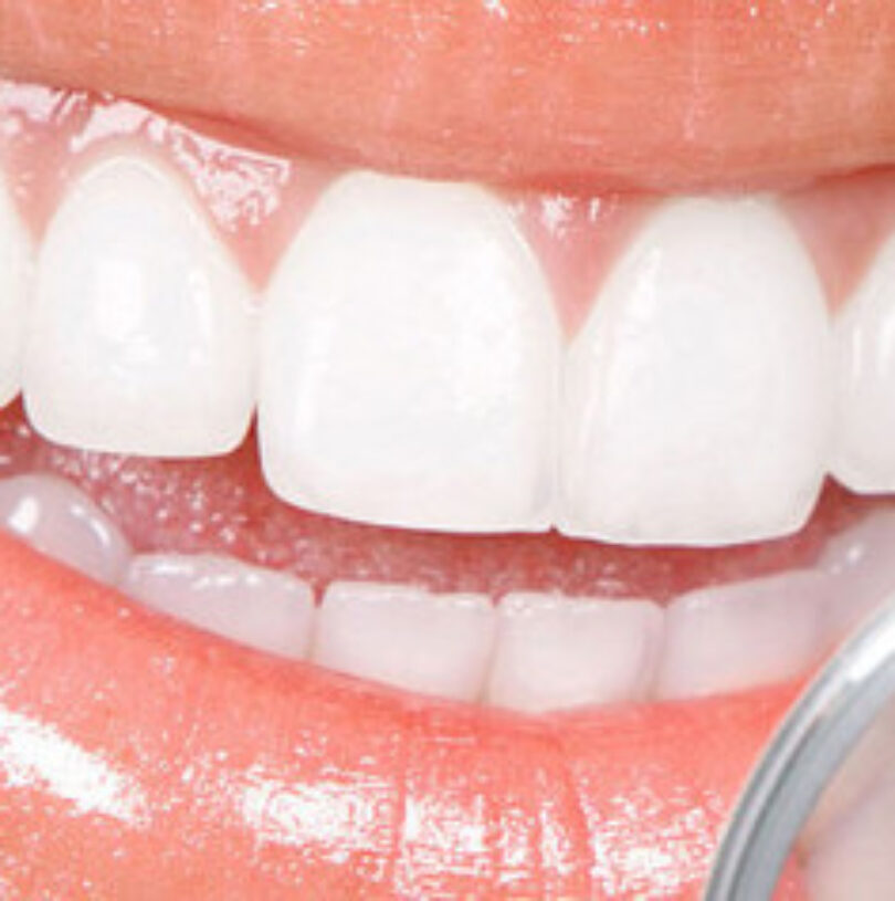 blog - Cheadle Hulme Dental